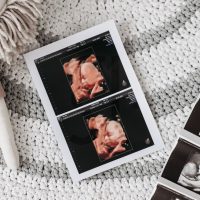 cyprus ivf