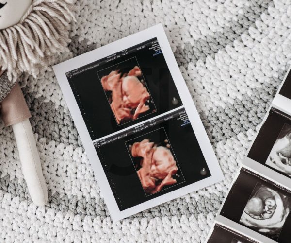 cyprus ivf