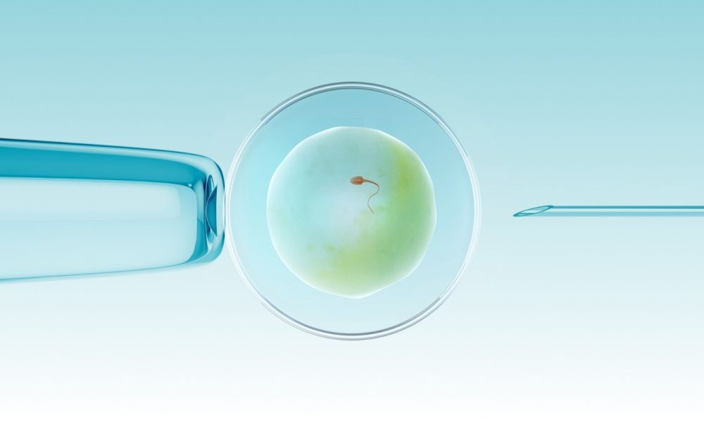 ivf