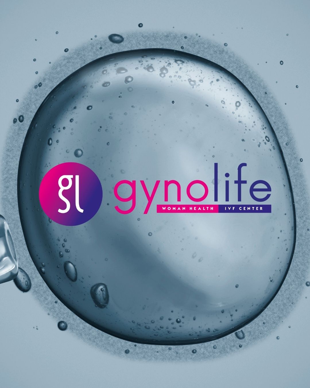 ivf vruchtbaarheid cyprus
