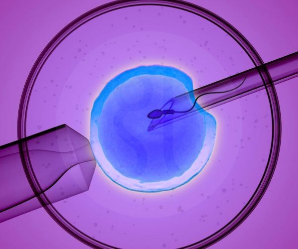 Microchip IVF